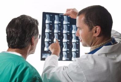 Doctor looks spinal pictures