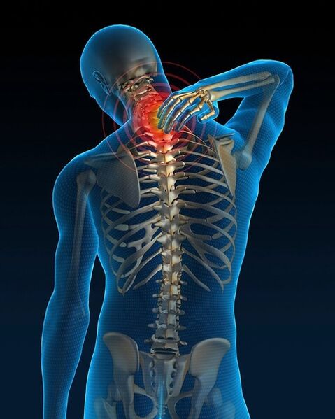 At the initial stage of treatment of cervical osteochondrosis, pain in the neck increases